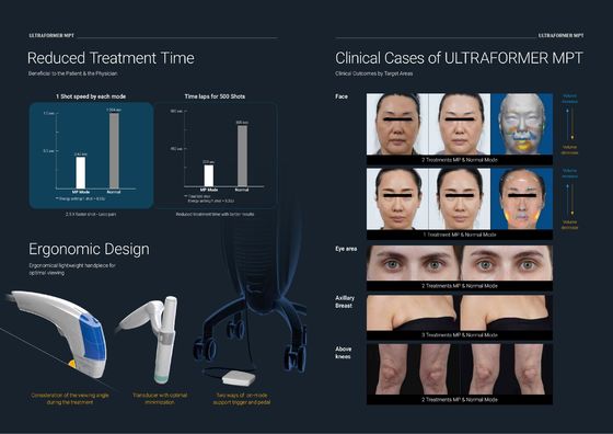 Korean New HIFU Facial Ultrasound Machine Macro And Micro-Focused Ultrasound MMFU HIFU Anti-Aging/ Chin Lifting /Wrinkle Removal / Saggy Skin Tightening Treatment
